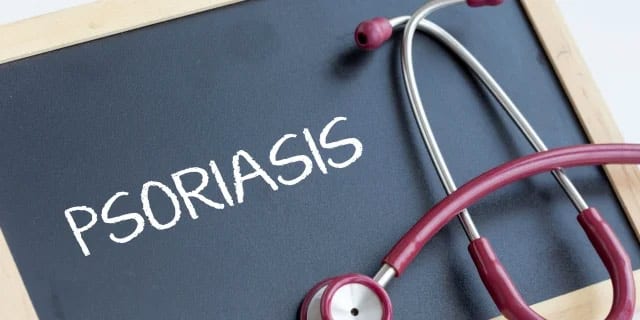 Psoriasis written on a chalkboard